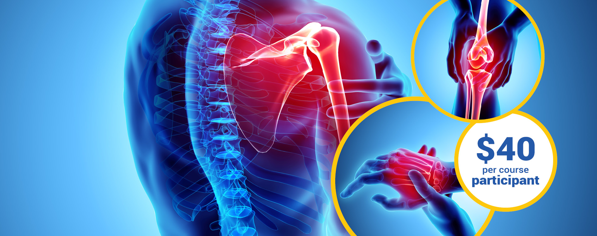 RSI Awareness Day Ergonomics Training Offer